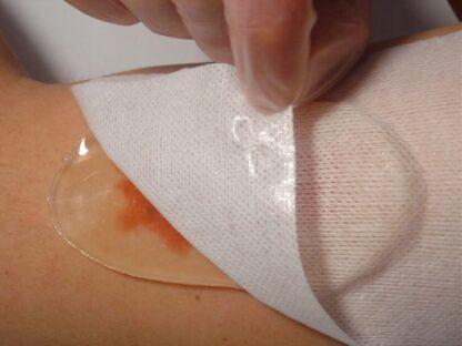 Opatrunek hydrożelowy AQUA GEL Ø 5 cm
